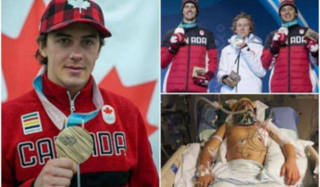 Mark-McMorris.jpg