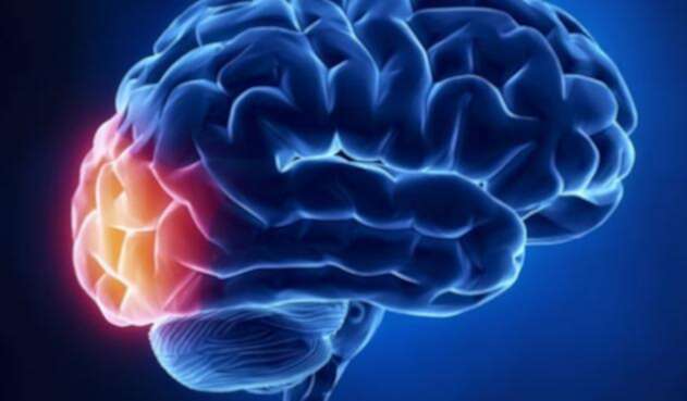cerebroquiz1.jpg