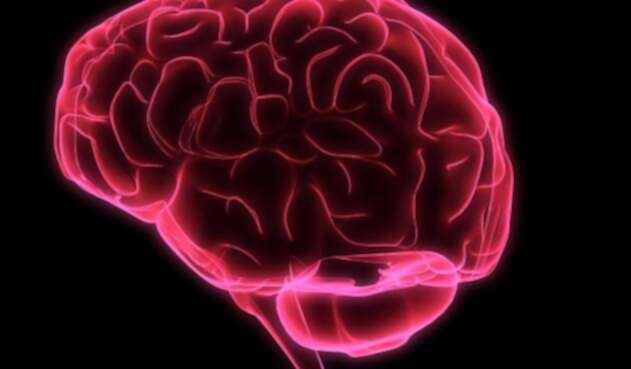 cerebrorefingimagelafm1.jpg