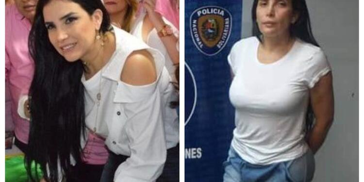 Aida Merlano antes y despúes