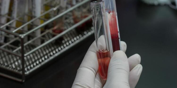Examen de sangre Examen de sangre