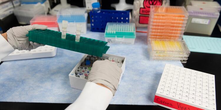 Pruebas de coronavirus