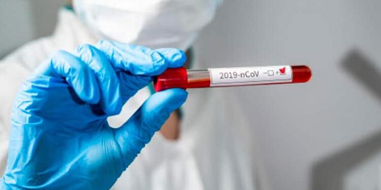 Prueba de coronavirus