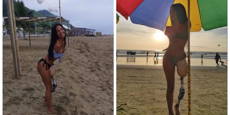 Victoria Salcedo, la modelo sin brazos ni una pierna