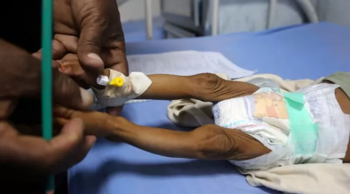 Desnutrición infantil