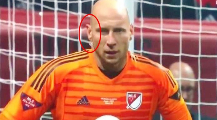 El arquero Brad Guzan en el Partido de las Estrellas de la MLS