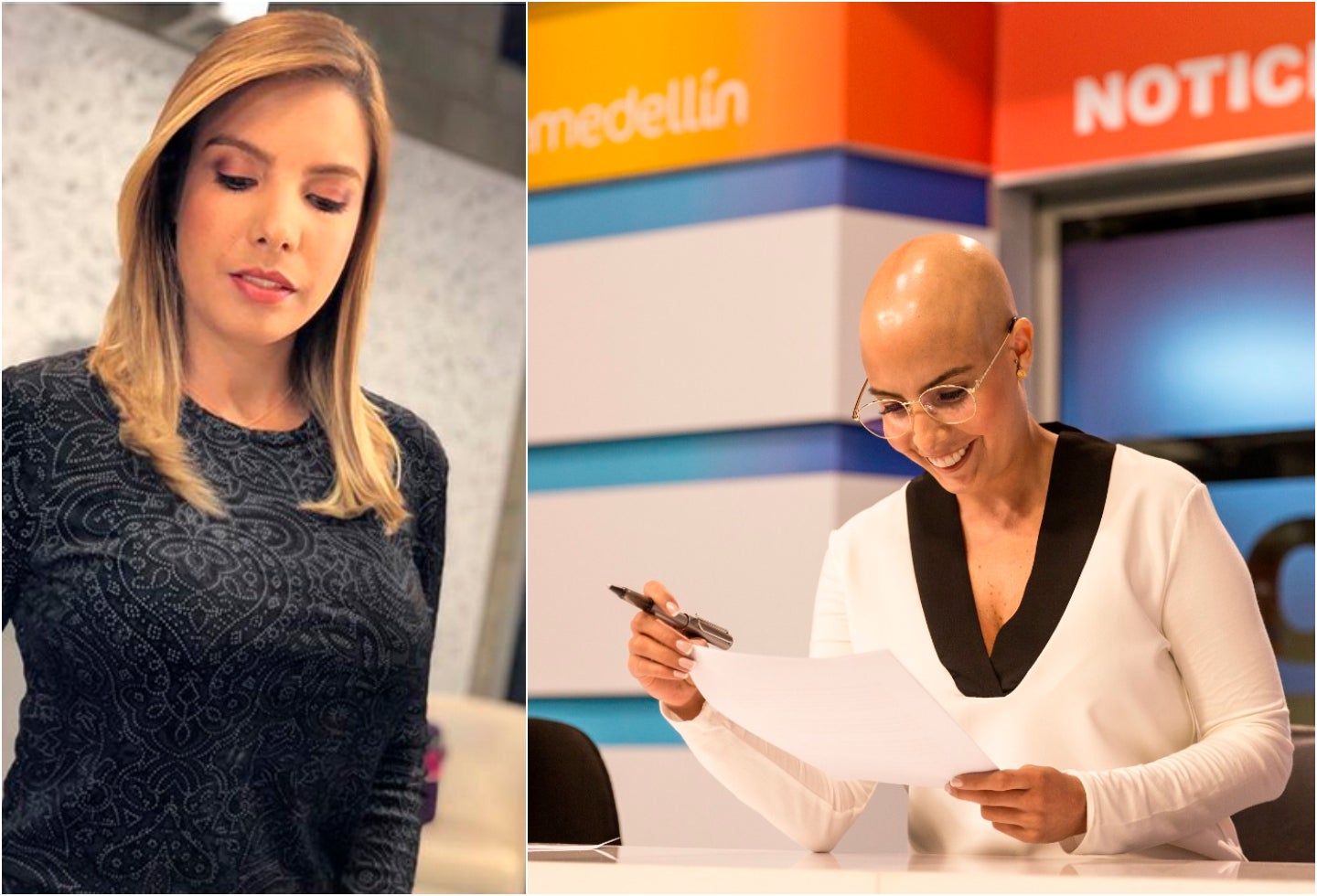 Manuela Estévez, presentadora, antes y después de asumir su esclerodermia