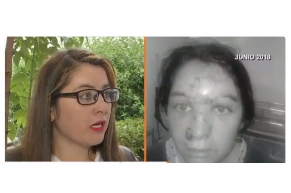 Mujer debió hacerse la muerta ante maltrato de su expareja