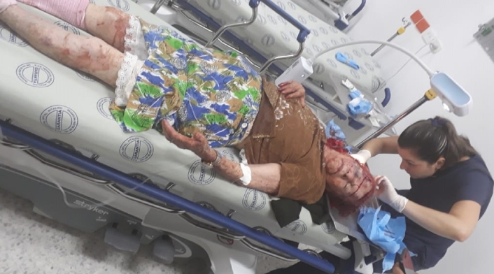 La adulta mayor sufrió graves heridas en el rostro y la cabeza.