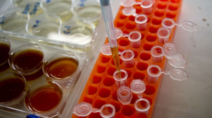 En Colombia las bacterias resistentes a los antibióticos ha incrementado. En Colombia las bacterias resistentes a los antibióticos ha incrementado.
