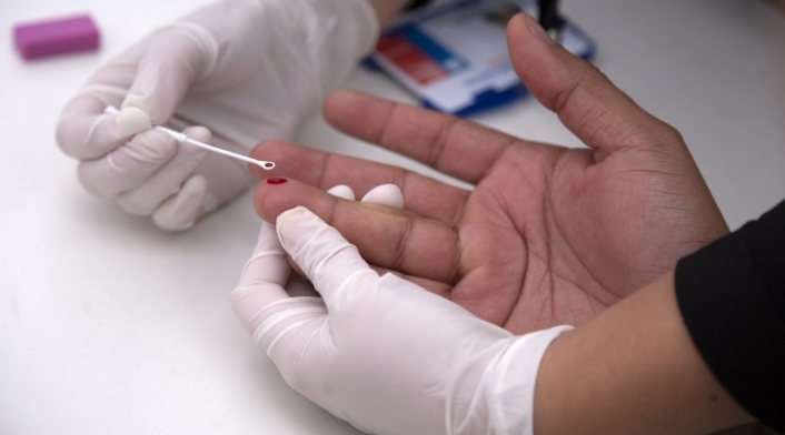 Prueba para detectar el VIH. Prueba VIH