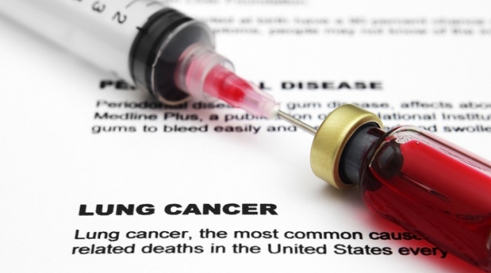 Pruebas de Cáncer