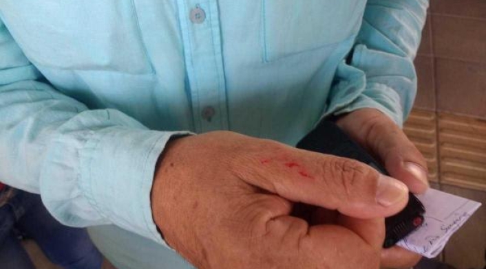Incidente de Ricardo Pérez