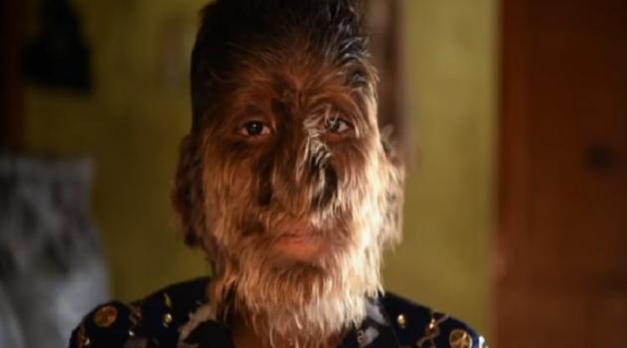 Hombre lobo