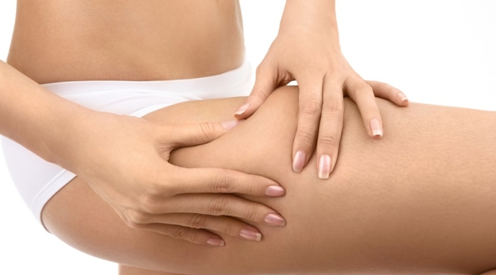 Celulitis Celulitis