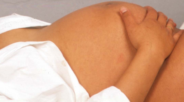 Mujer en estado de gestación