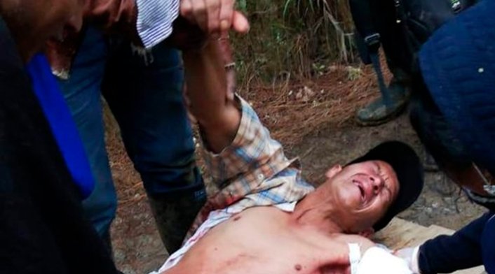 El indígena Breiner Yunda Camayo tras ser impactado en medio de la minga
