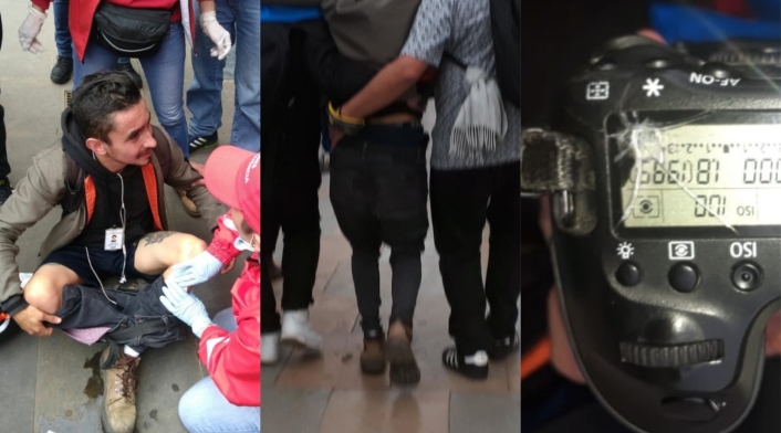 Fotógrafo agredido Fotógrafo agredido