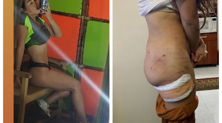 Yina Calderón se quitó la cola