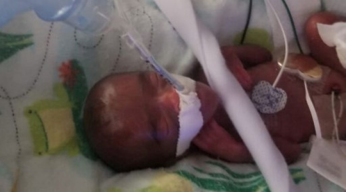 Bebe mas pequeño del mundo Bebe mas pequeño del mundo