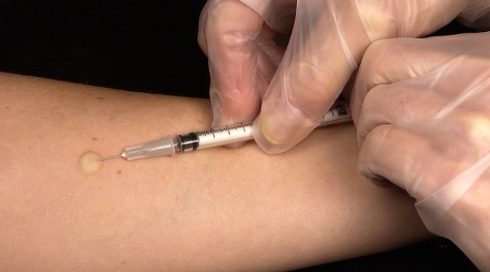 virus de VIH