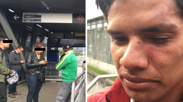 Agredido en Transmilenio