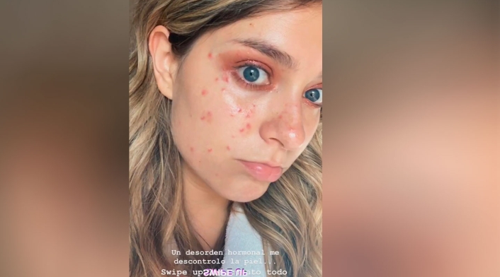 Cara de Laura Tobón