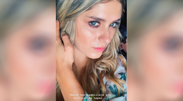 Rostro de Laura Tobón