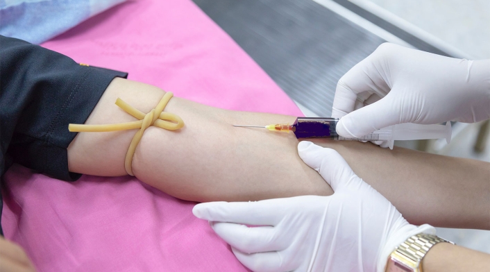 Toma de muestra de sangre Toma de muestra de sangre