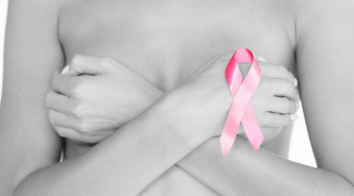 Cáncer de mama Cáncer de mama