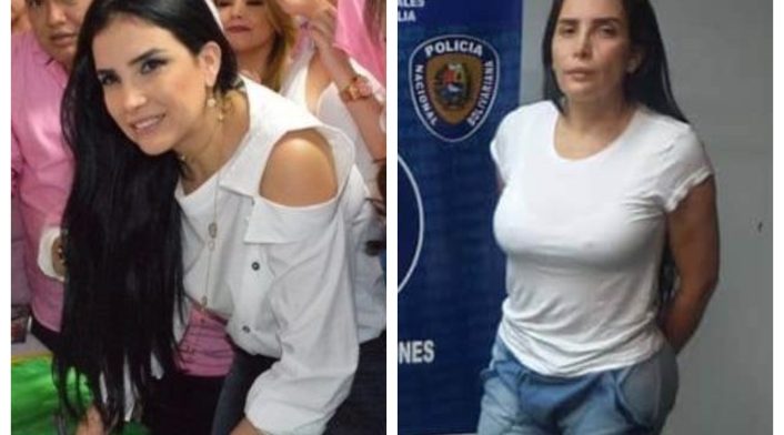Aida Merlano antes y despúes