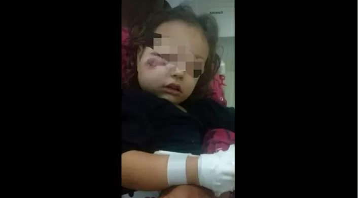Fotos de la niña agredida han dejado constancia de la violencia con la que fue golpeada