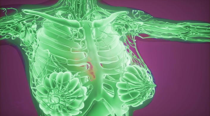 Tecnología detectaría cáncer de seno