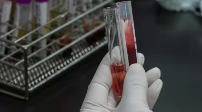 Examen de sangre Examen de sangre