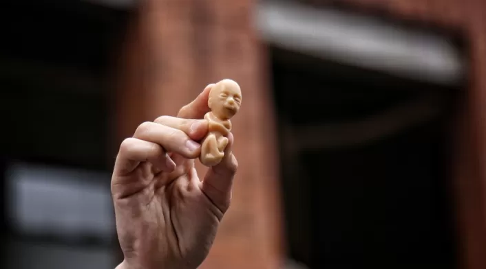 Aborto en Colombia Aborto en Colombia