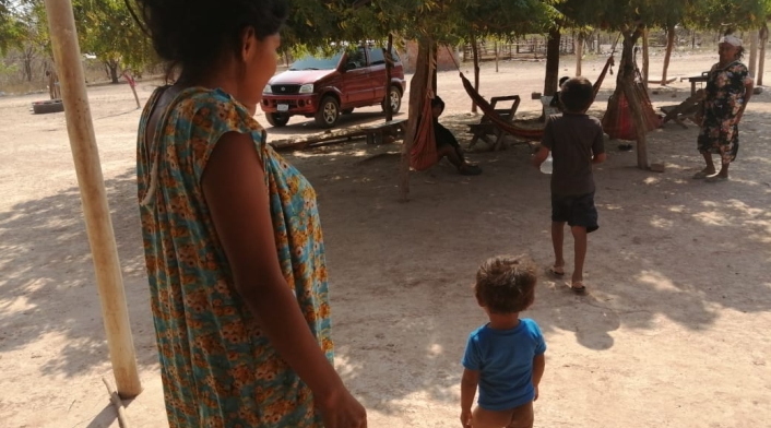 Niños con desnutrición en La Guajira