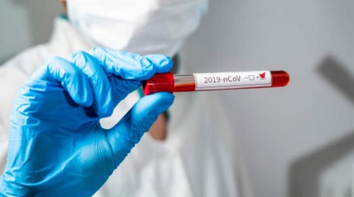 Prueba de coronavirus