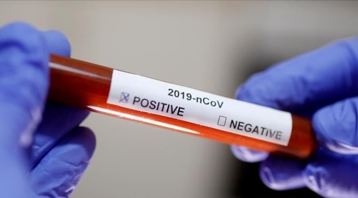 Pruebas de coronavirus en Colombia