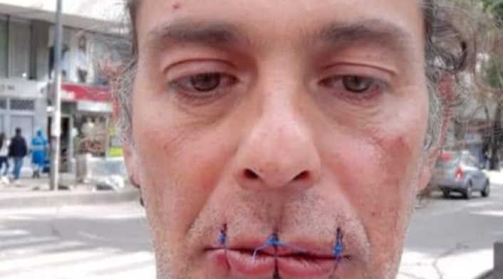 Artista se cose la boca