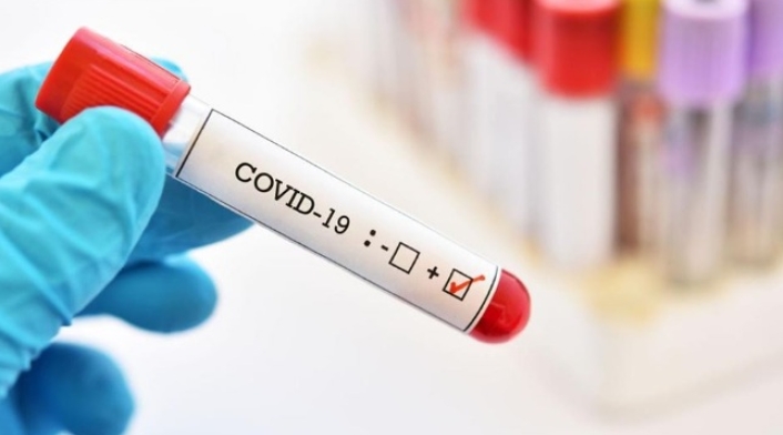 Prueba de coronavirus Prueba de coronavirus