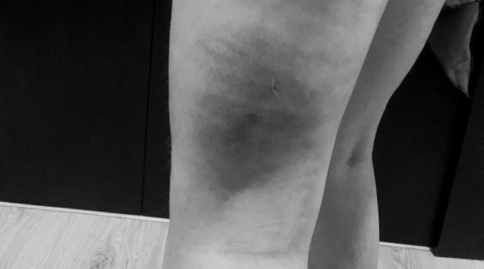 Agresión a mujeres Agresión a mujeres