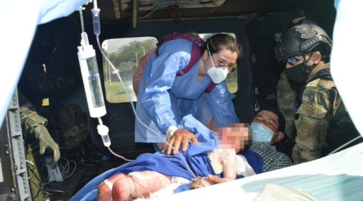 Niño quemado en Santander