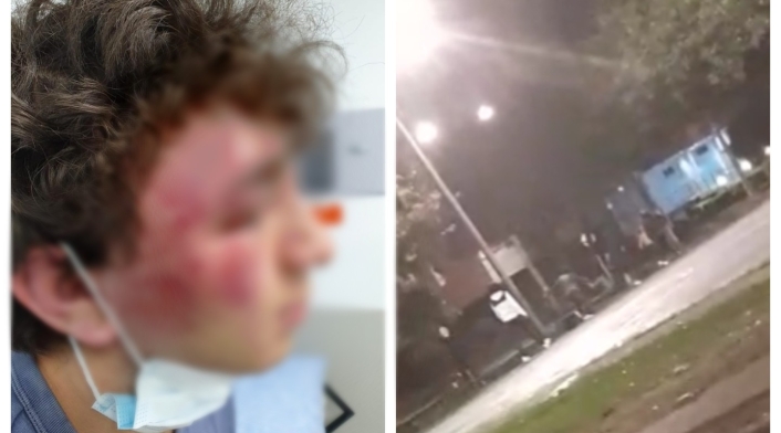 Golpiza a menor en Suba