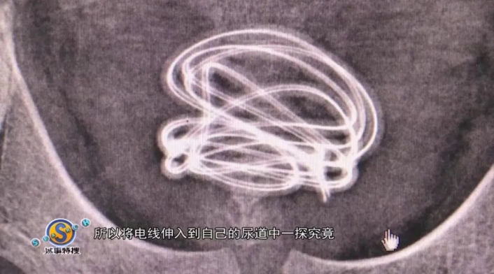 Cable 2