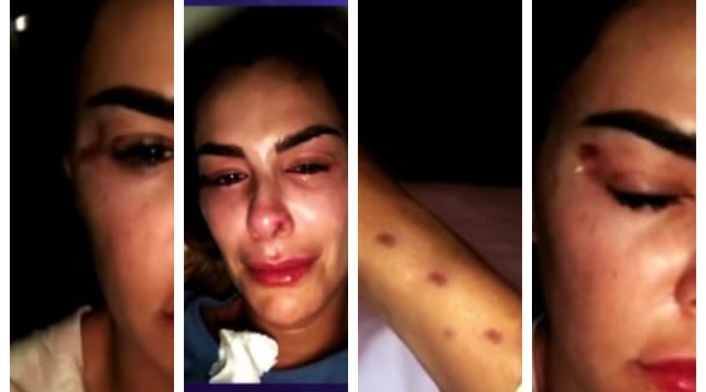 Ninel Conde con golpes en su rostro