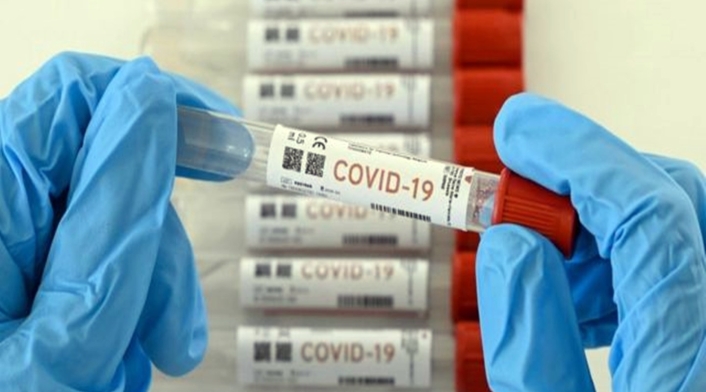 Pruebas Covid-19 imagen de referencia