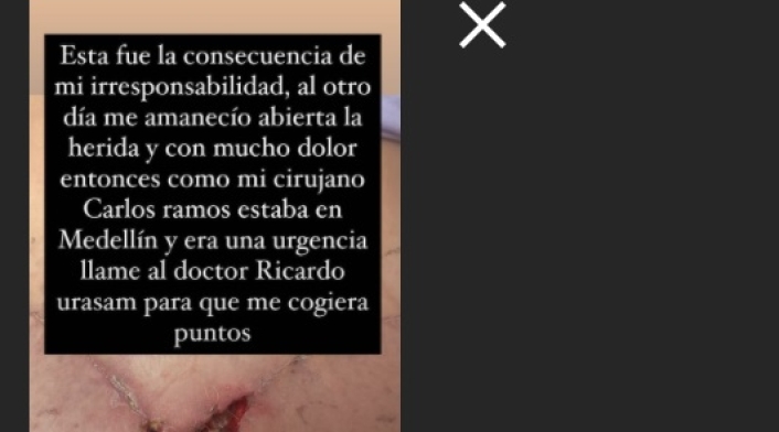 Cirugía a Yina Calderón