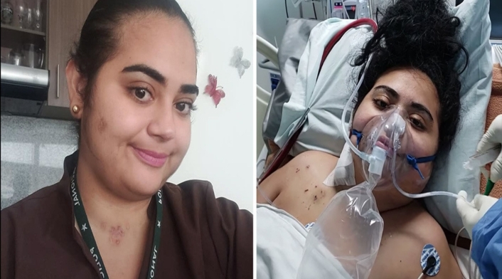 Médica colombiana olvidó hablar y escribir tras enfrentar el coronavirus