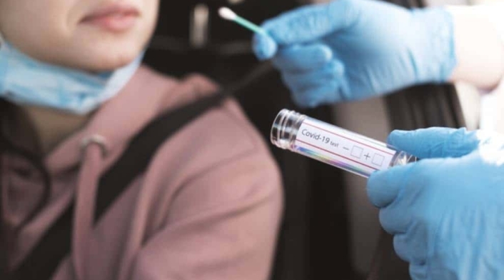 Prueba PCR Prueba PCR