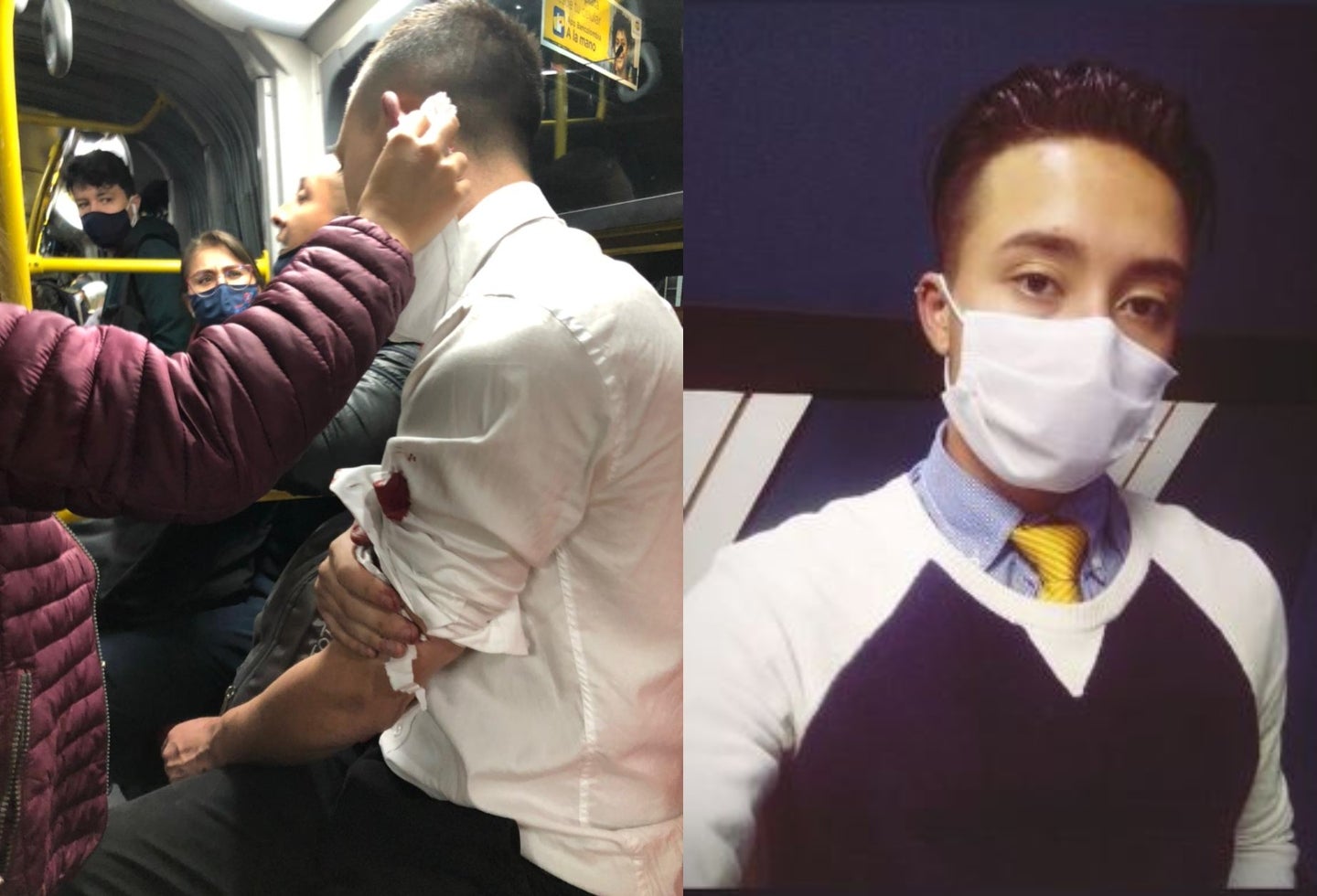 Apuñalan a periodista en Transmilenio por robarle el celular